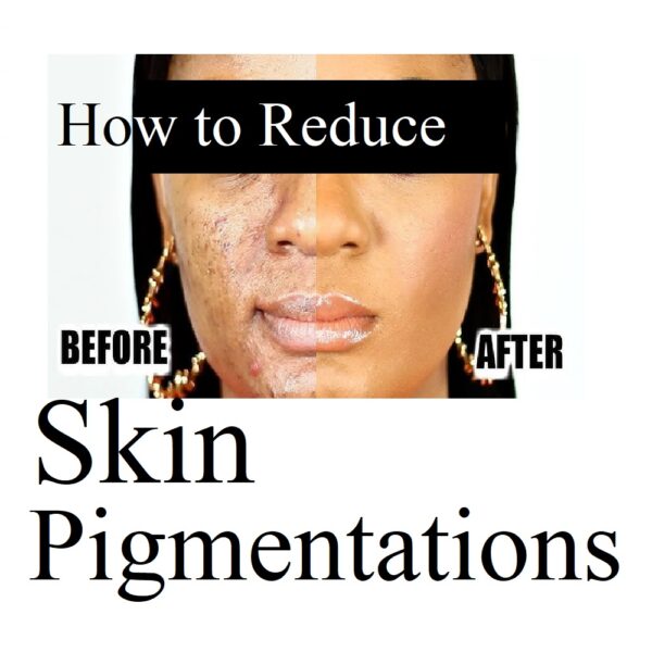 Pigmentation Product Set. (How to remove pigmentation at home naturally.)